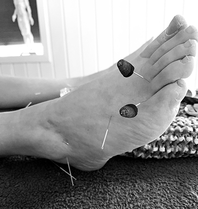 Schlie2022 Akupunktur