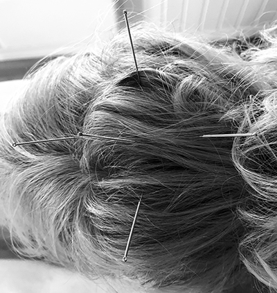 Schlie2022 Akupunktur